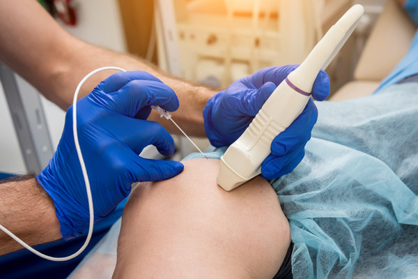 radiofrequency ablations in Garden City Long Island